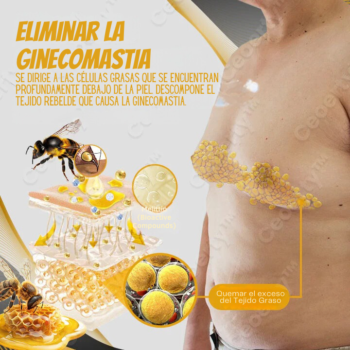 Men Therm Bee Venom Gynecomastia Heating Oil🐝🍯