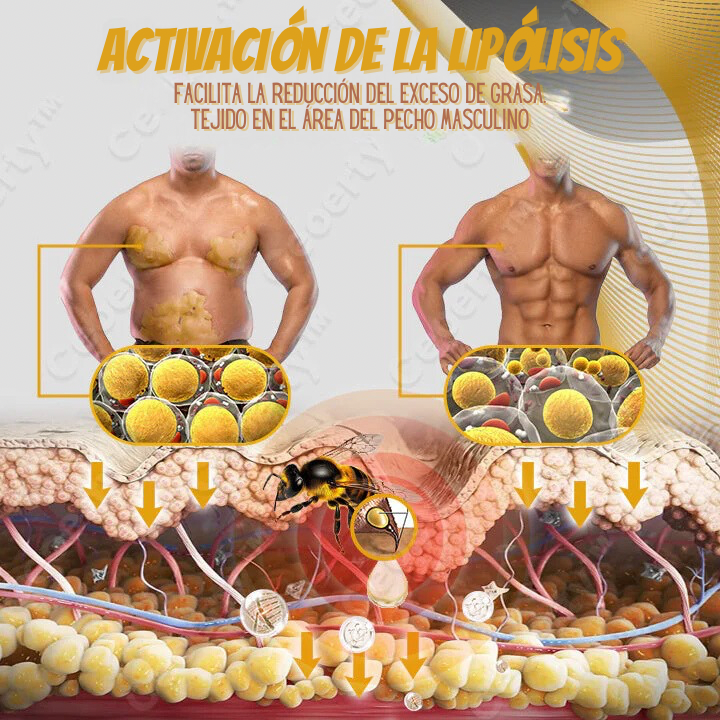 Men Therm Bee Venom Gynecomastia Heating Oil🐝🍯