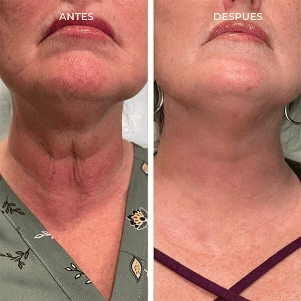 💉💧BOTOX FACE SERUM💧💉