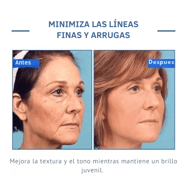 💉💧BOTOX FACE SERUM💧💉