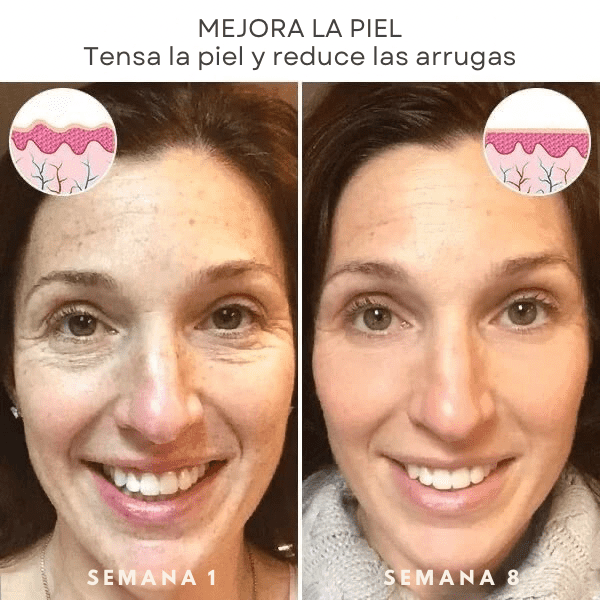 💉💧BOTOX FACE SERUM💧💉