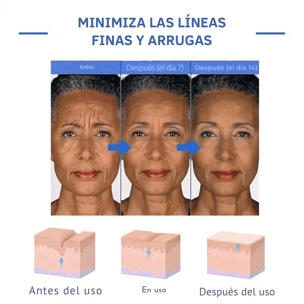 💉💧BOTOX FACE SERUM💧💉