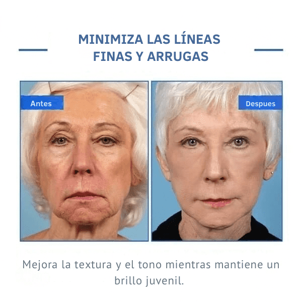 💉💧BOTOX FACE SERUM💧💉